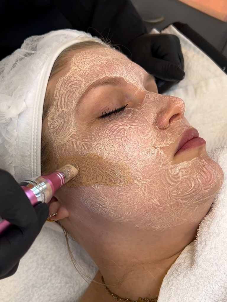 Bild zeigt eine Kundin, die eine Gesichtsbehandlung in Leonberg erhält Aquafacial in Leonberg Microneedling in Leonberg